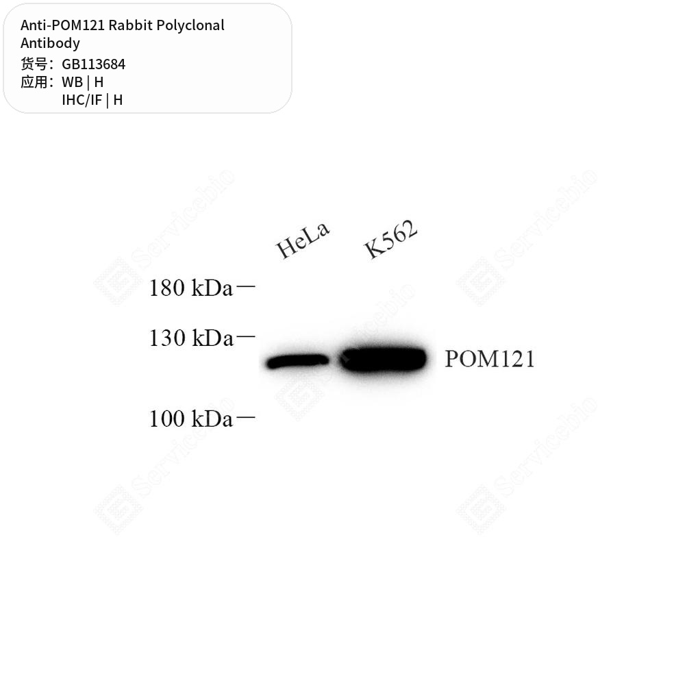 Антитела первичные, поликлональные кролика к POM121 человека, 50 мкл