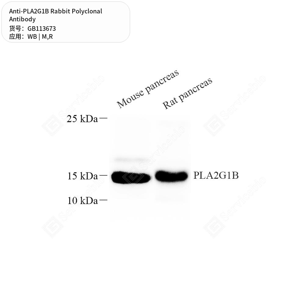 Антитела первичные, поликлональные кролика к PLA2G1B крысы, мыши, 50 мкл