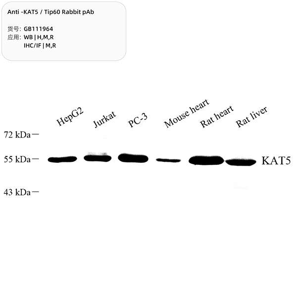 Антитела первичные, поликлональные, KAT5/Tip60, 100 мкл