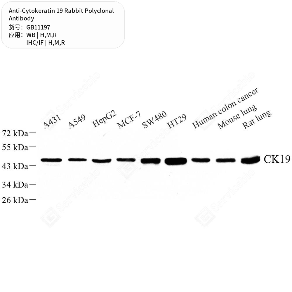 Антитела первичные, поликлональные кролика к Cytokeratin 19 крысы, мыши, человека, 100 мкл