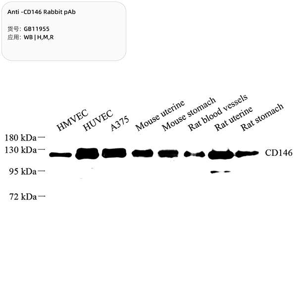 Антитела первичные, поликлональные, CD146, 100 мкл