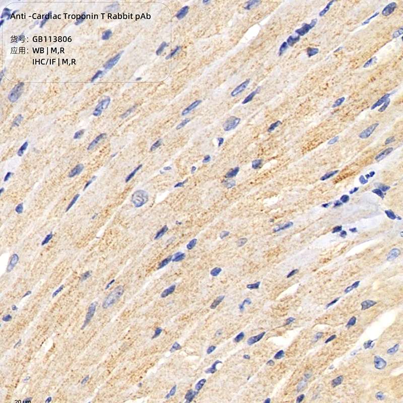 Антитела первичные, поликлональные, Cardiac Troponin T, 100 мкл