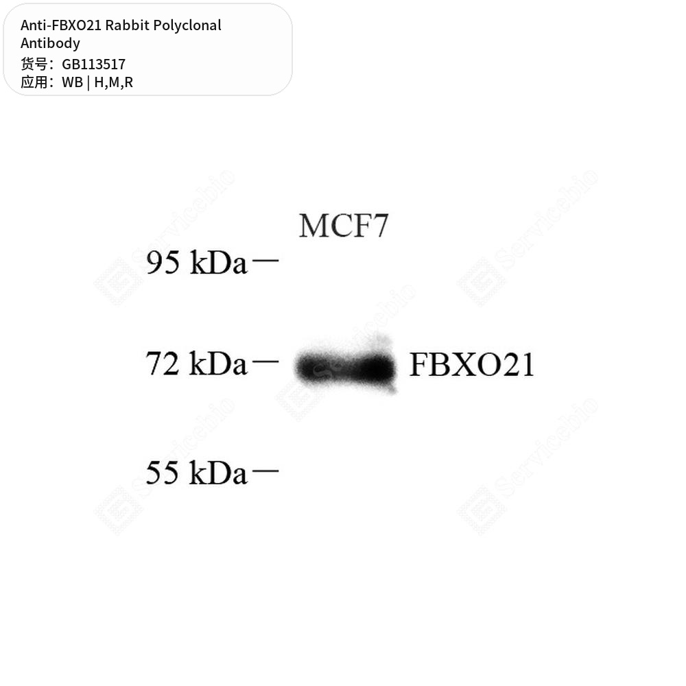 Антитела первичные, поликлональные кролика к FBXO21 крысы, мыши, человека, 50 мкл