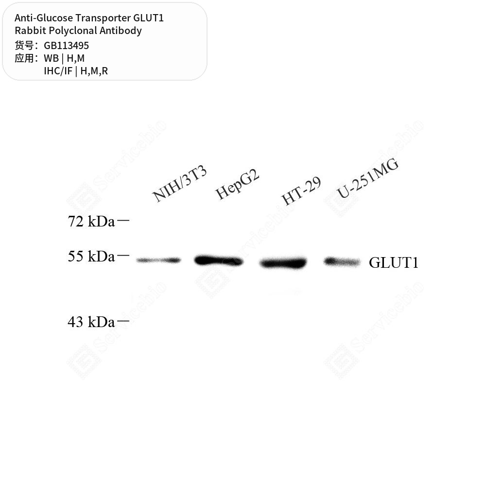 Антитела первичные, поликл. кролика к Glucose Transporter GLUT1 крысы, мыши, человека, 100 мкл