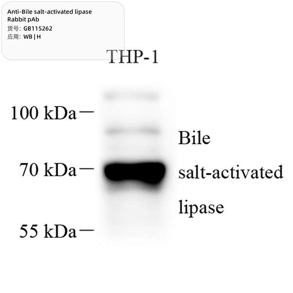 Антитела первичные, поликлональные, Bile salt-activated lipase, 100 мкл
