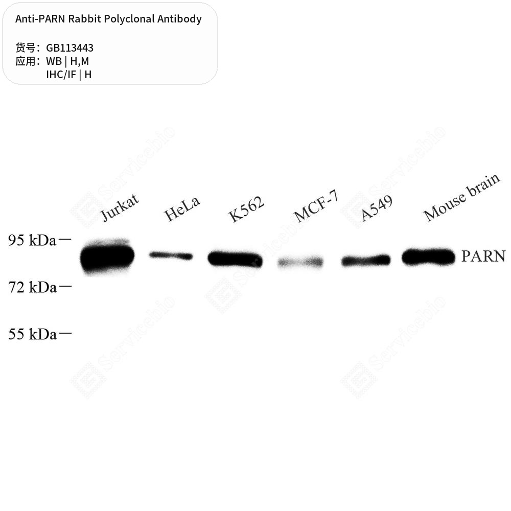 Антитела первичные, поликлональные кролика к PARN мыши, человека, 50 мкл