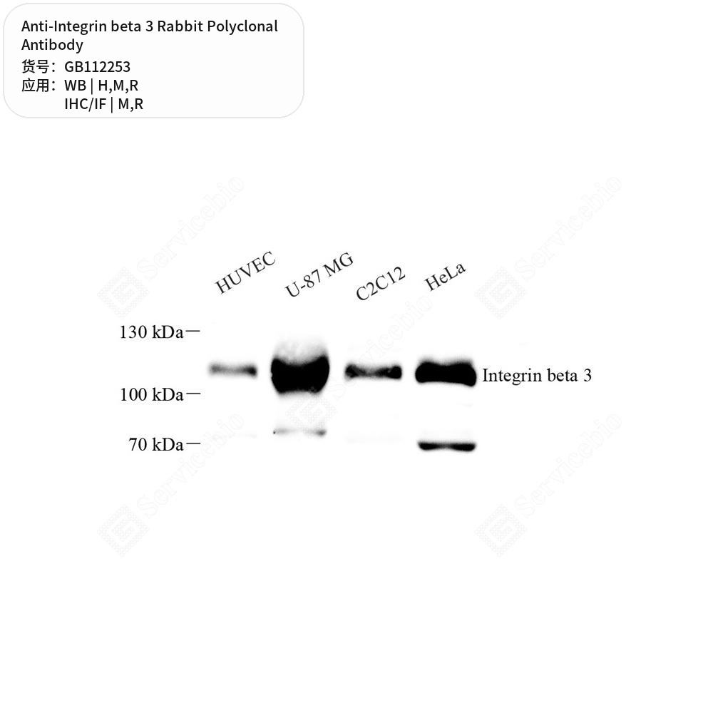 Антитела первичные, поликлональные кролика к Integrin beta 3 крысы, мыши, человека, 100 мкл