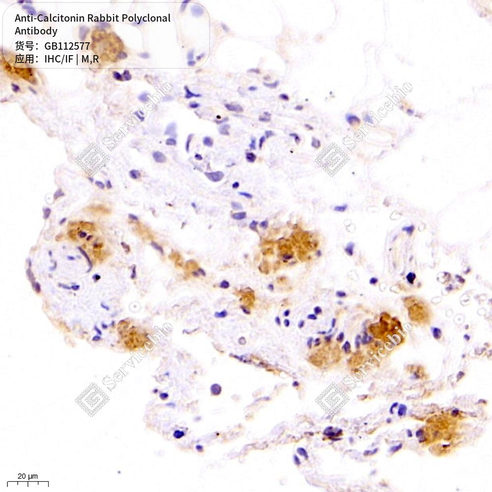 Антитела первичные, поликлональные кролика к Calcitonin крысы, мыши, 100 мкл
