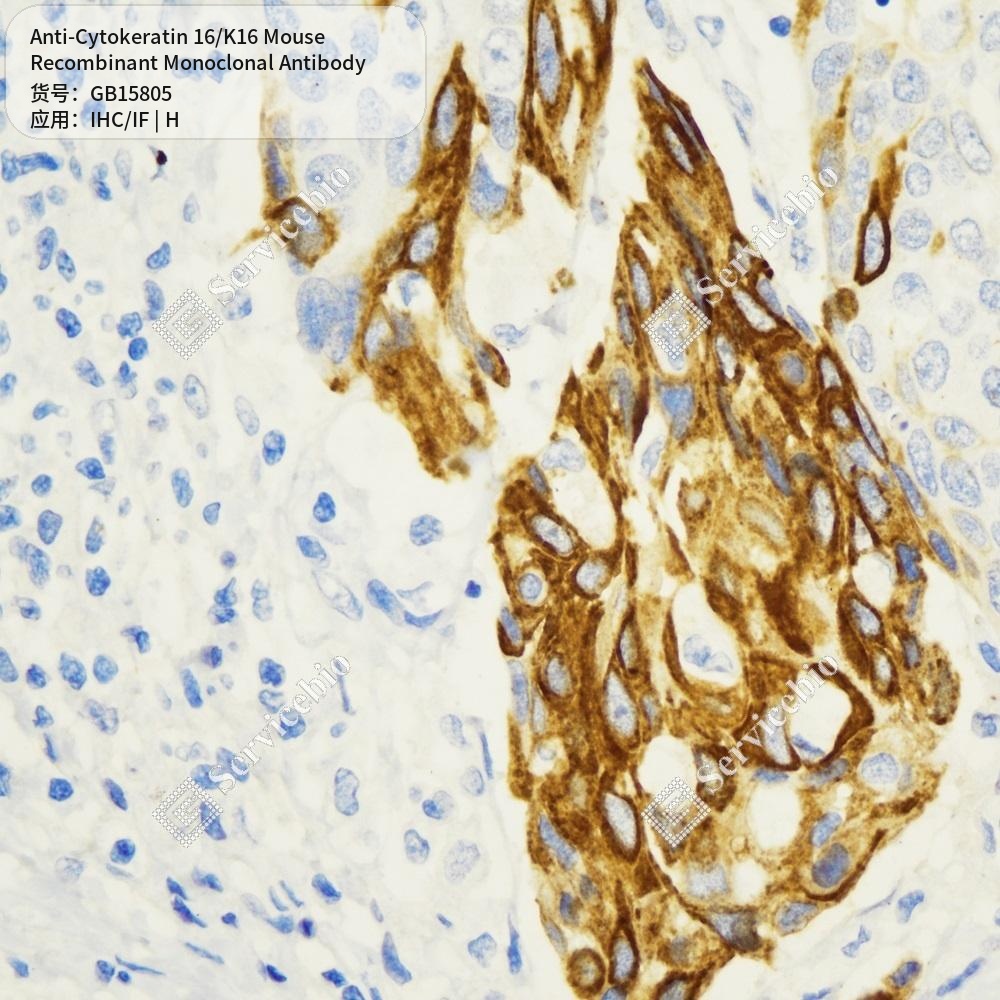 Антитела первичные, моноклональные мыши к Cytokeratin 16/K16 человека, 100 мкл