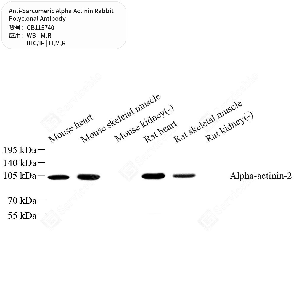 Антитела первичные, поликлональные кролика к Sarcomeric Alpha Actinin крысы, мыши, человека, 50 мкл