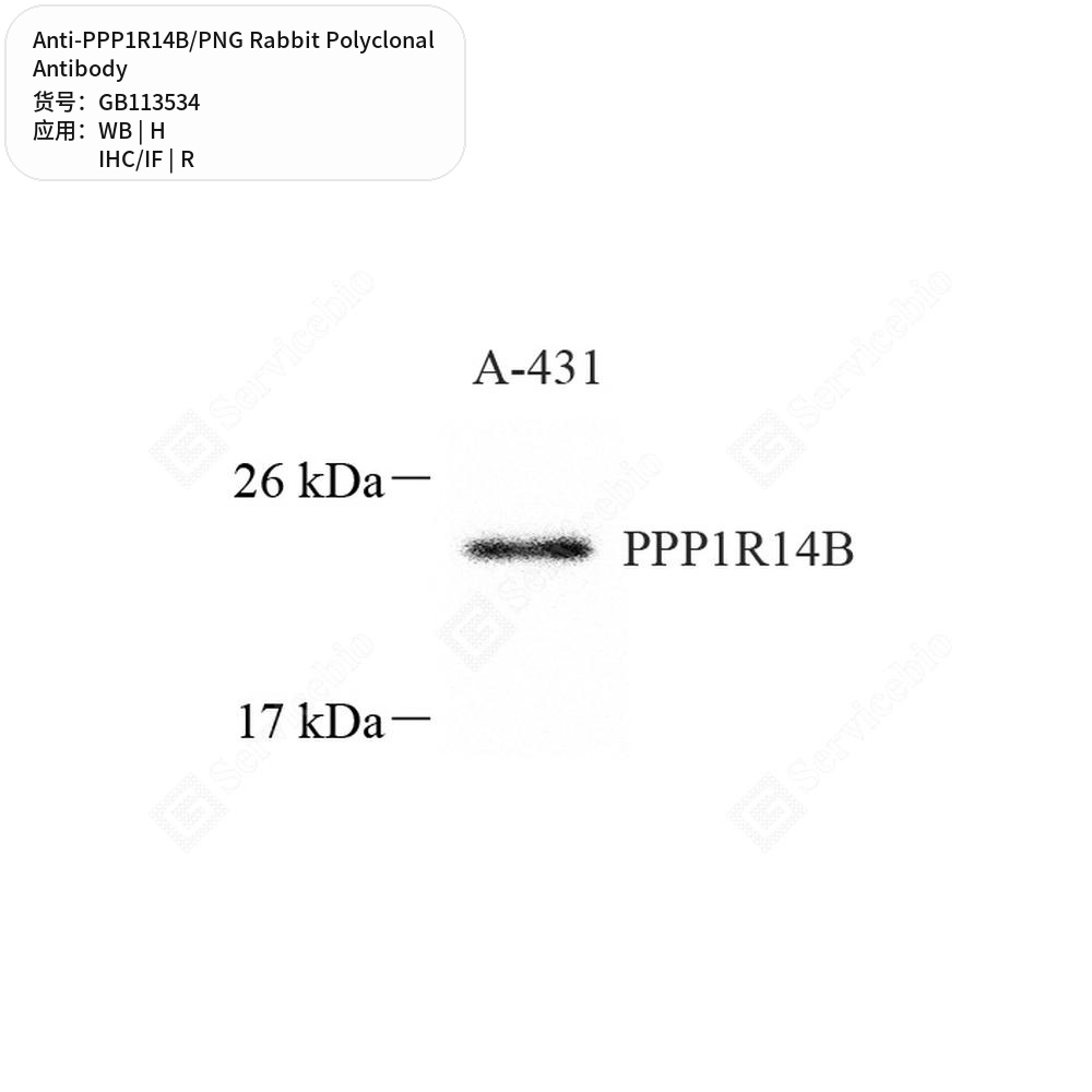 Антитела первичные, поликлональные кролика к PPP1R14B/PNG крысы, человека, 100 мкл