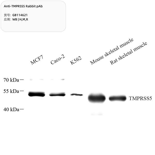 Антитела первичные, поликлональные, TMPRSS5, 100 мкл