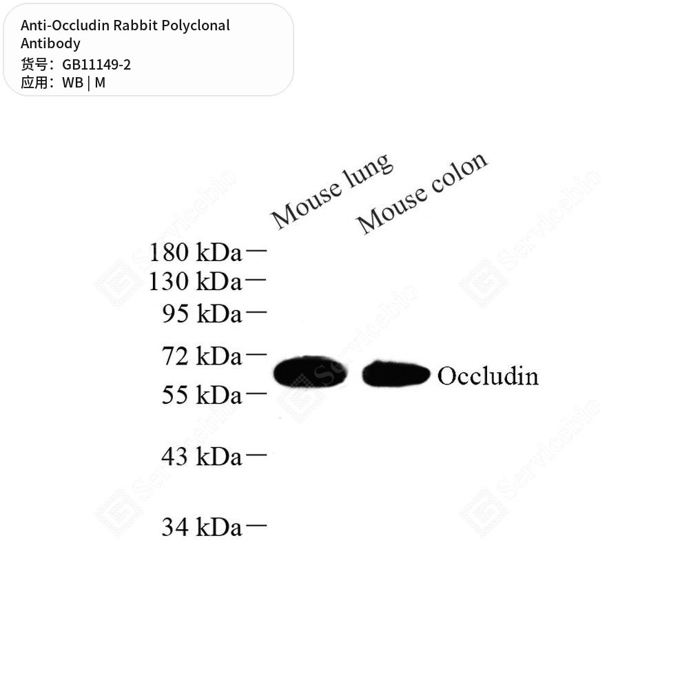 Антитела первичные, поликлональные кролика к Occludin мыши, 100 мкл