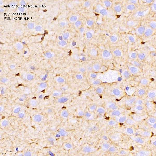 Антитела первичные, моноклональные, S100 beta, 100 мкл