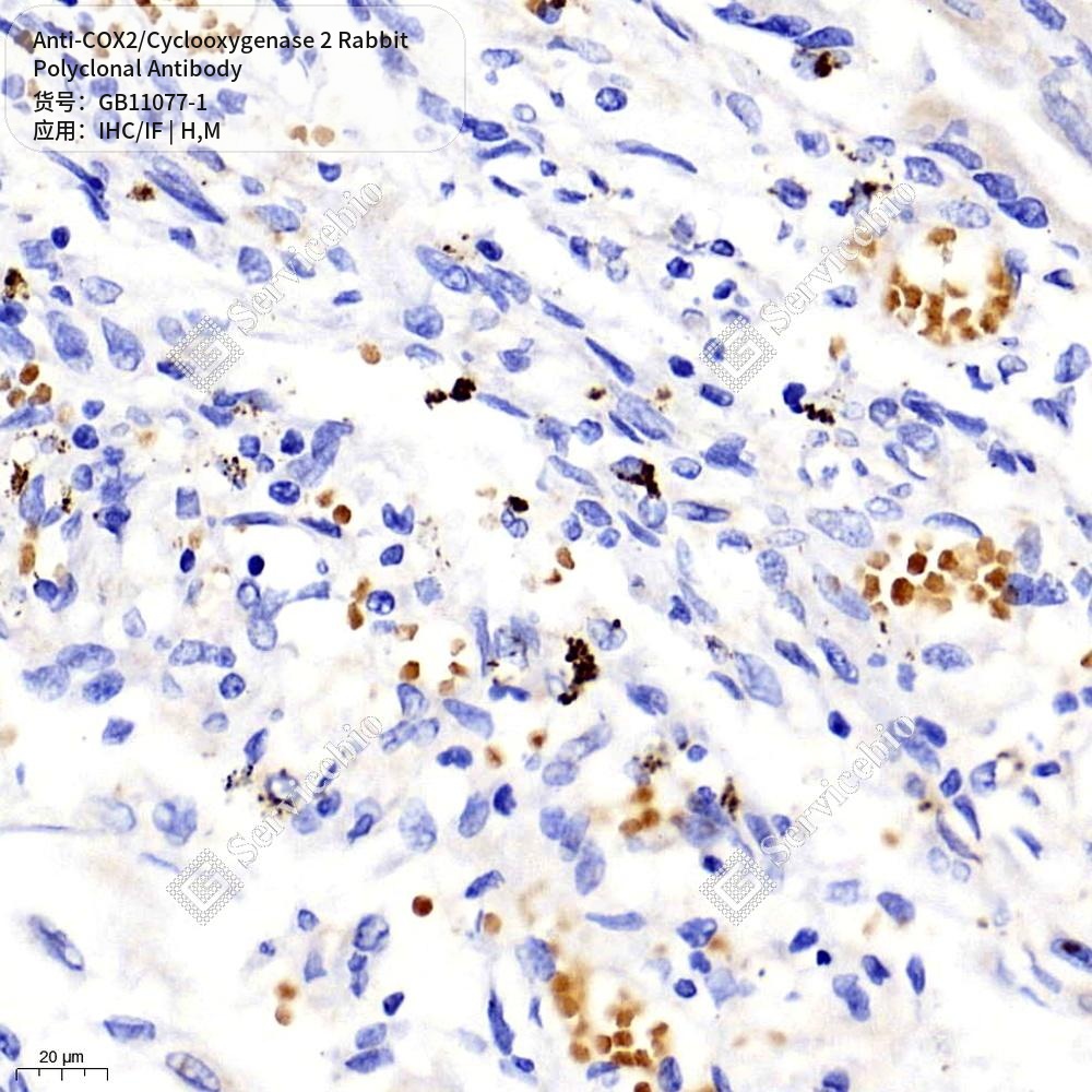Антитела первичные, поликлональные кролика к COX2/Cyclooxygenase 2 мыши, человека, 100 мкл
