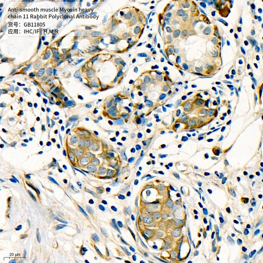 Антитела первичные, пол. крол. к smooth muscle Myosin heavy chain 11 крысы, мыши, человека, 50 мкл