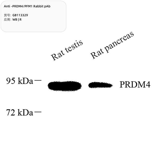 Антитела первичные, поликлональные, PRDM4/PFM1, 100 мкл