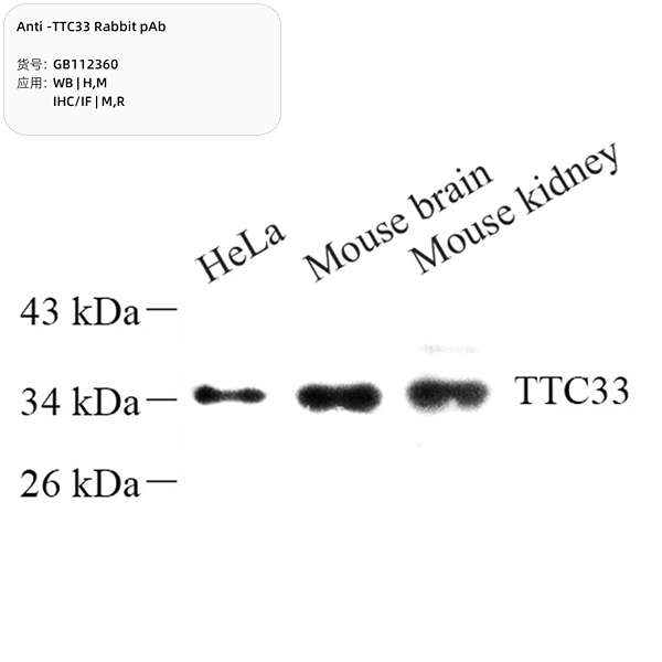 Антитела первичные, поликлональные, TTC33, 100 мкл