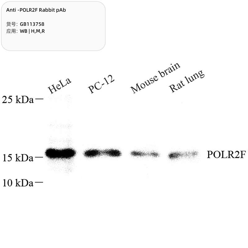 Антитела первичные, поликлональные, POLR2F, 100 мкл