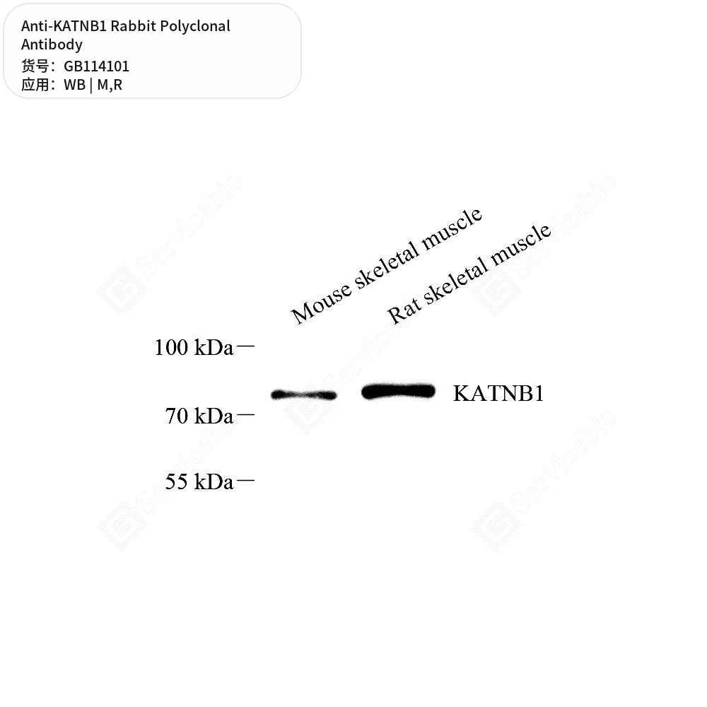 Антитела первичные, поликлональные кролика к KATNB1 крысы, мыши, 100 мкл