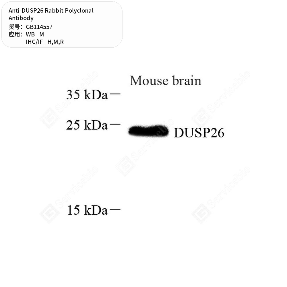 Антитела первичные, поликлональные кролика к DUSP26 крысы, мыши, человека, 100 мкл