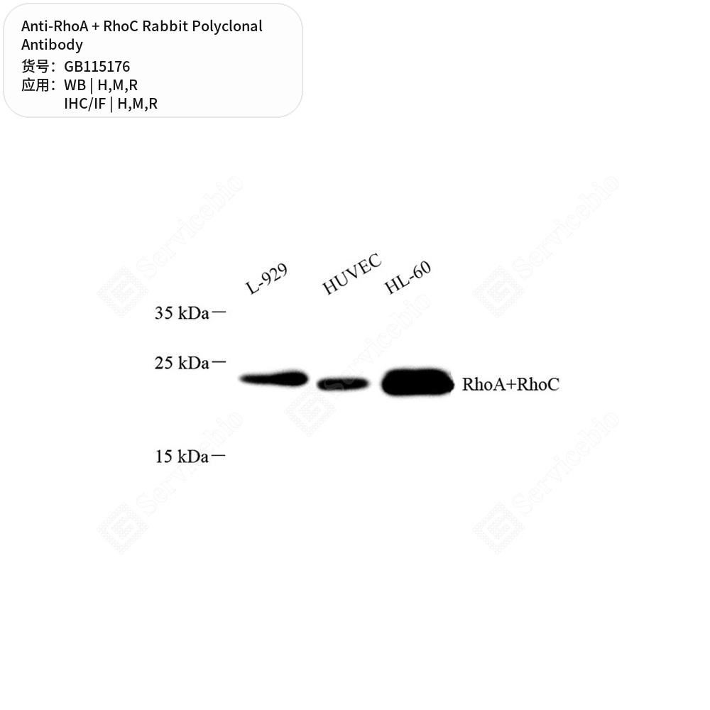 Антитела первичные, поликлональные кролика к RhoA + RhoC крысы, мыши, человека, 100 мкл