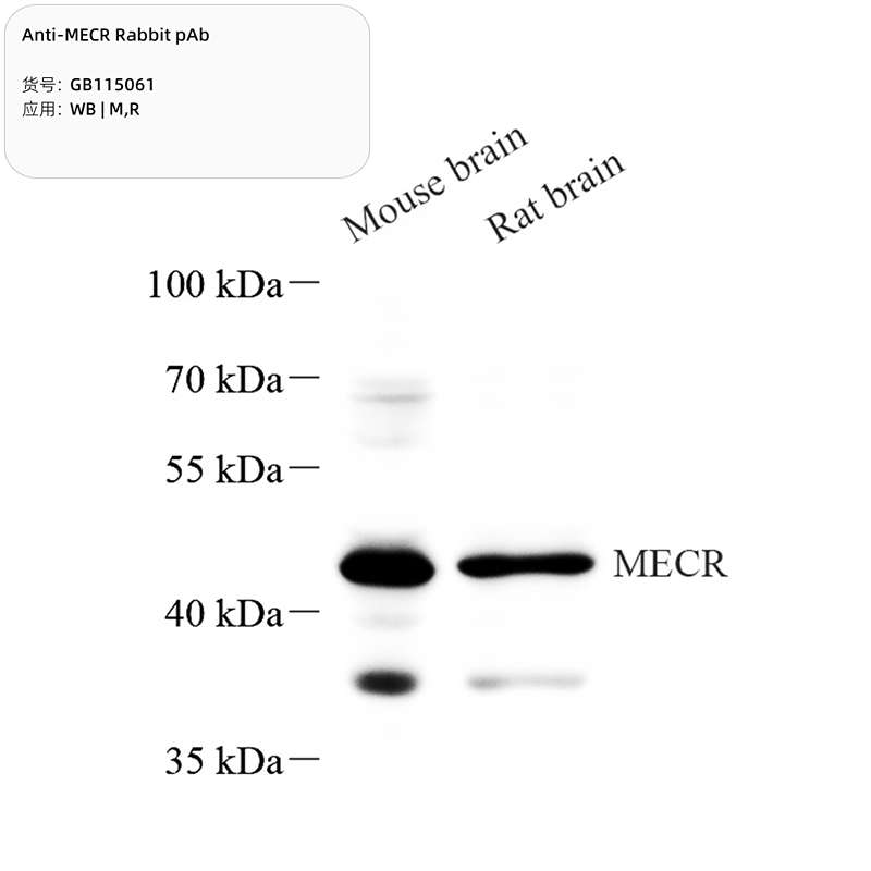 Антитела первичные, поликлональные, MECR, 100 мкл