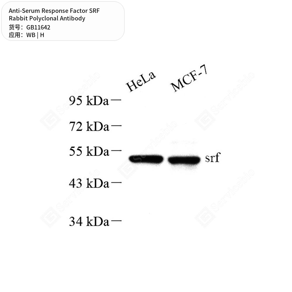 Антитела первичные, поликлональные кролика к Serum Response Factor SRF человека, 50 мкл