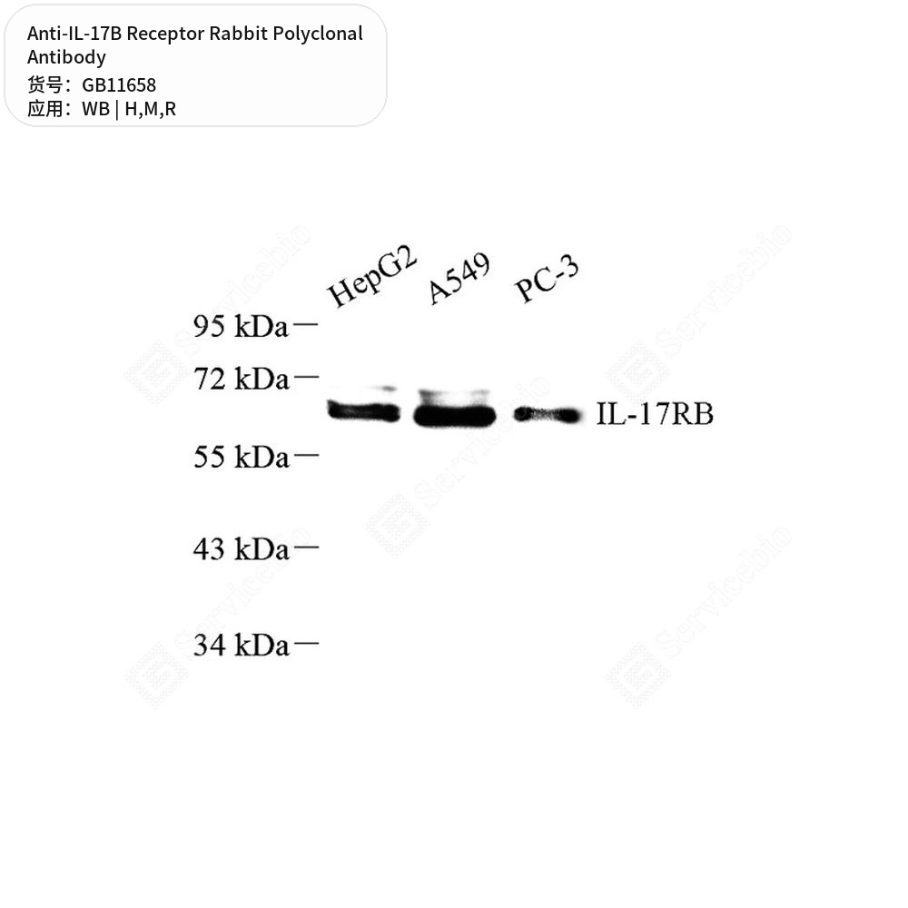 Антитела первичные, поликлональные кролика к IL-17B Receptor крысы, мыши, человека, 50 мкл