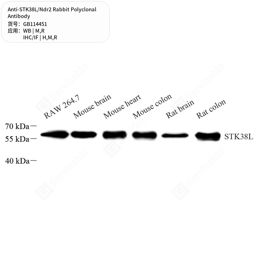 Антитела первичные, поликлональные кролика к STK38L/Ndr2 крысы, мыши, человека, 50 мкл
