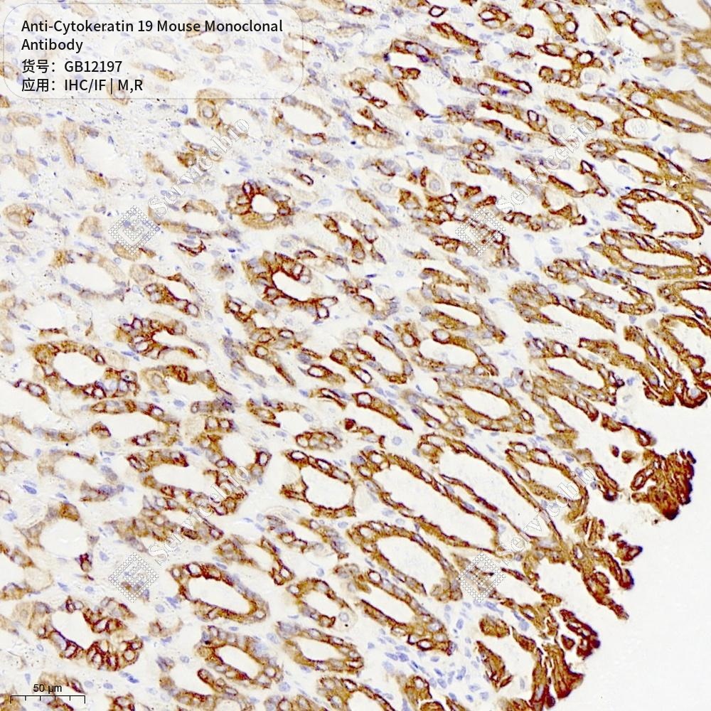 Антитела первичные, моноклональные мыши к Cytokeratin 19 крысы, мыши, 50 мкл