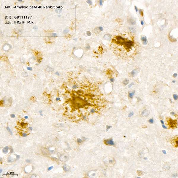 Антитела первичные, поликлональные, Amyloid beta 40, 100 мкл