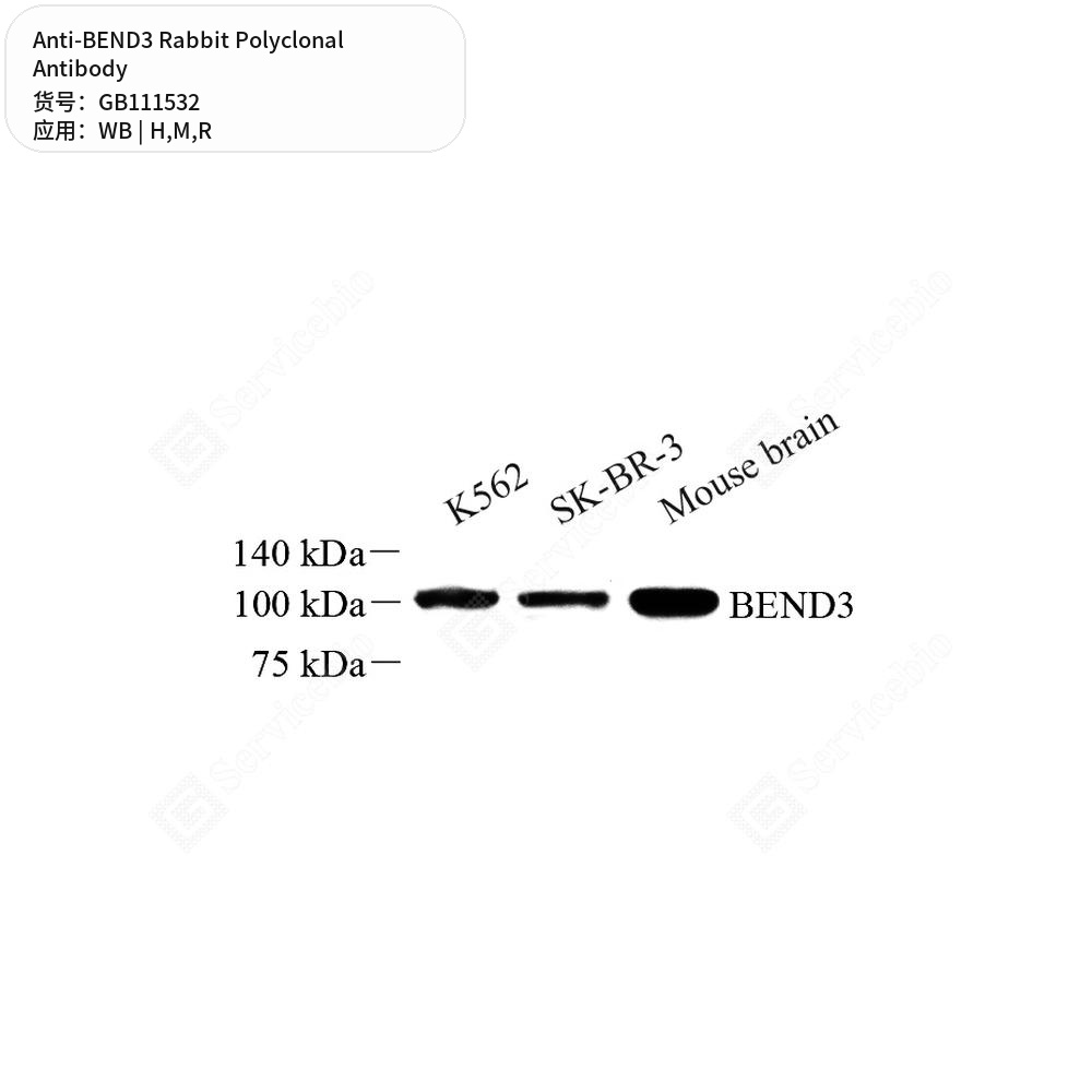 Антитела первичные, поликлональные кролика к BEND3 крысы, мыши, человека, 100 мкл