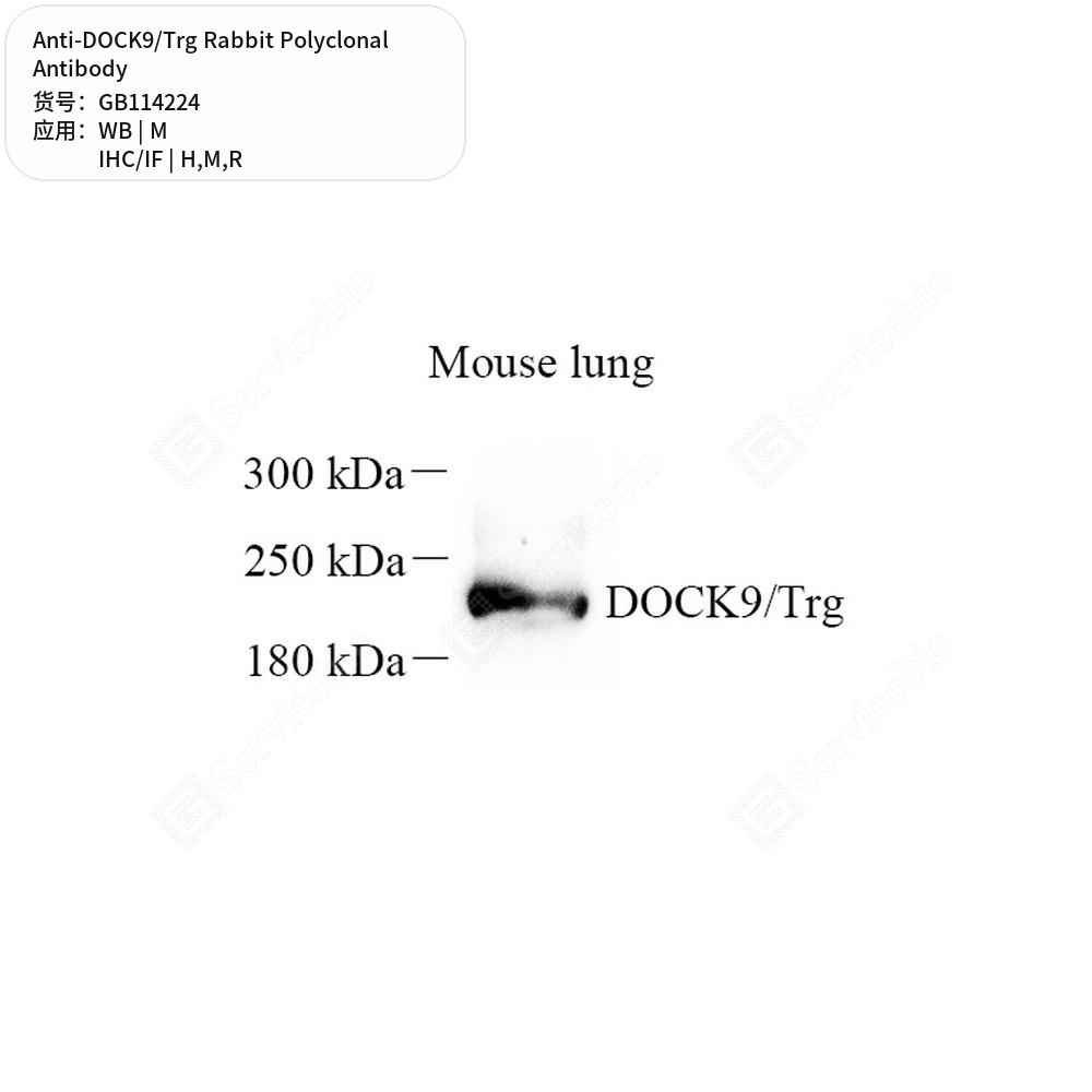 Антитела первичные, поликлональные кролика к DOCK9/Trg крысы, мыши, человека, 100 мкл