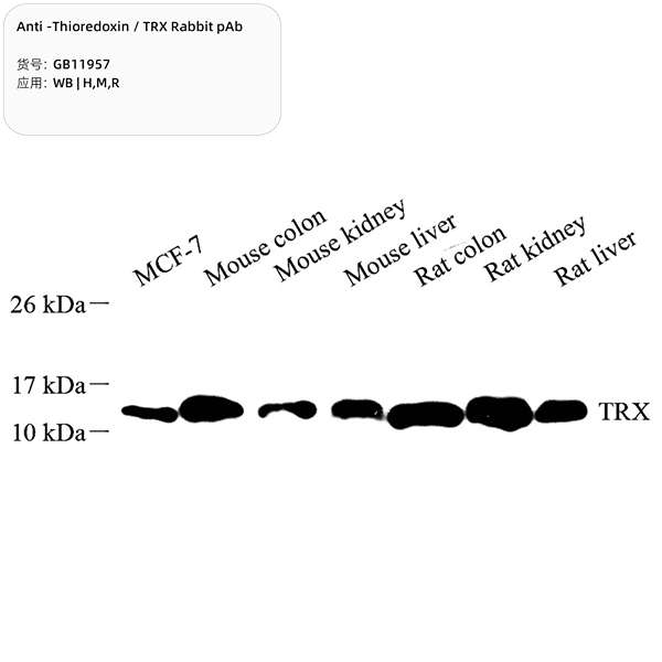 Антитела первичные, поликлональные, Thioredoxin/TRX, 100 мкл
