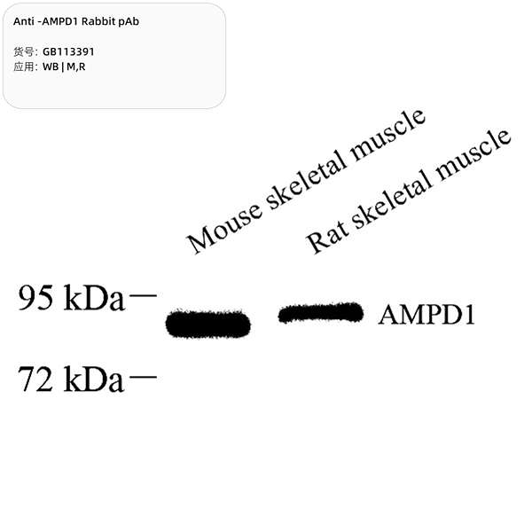 Антитела первичные, поликлональные, AMPD1, 100 мкл