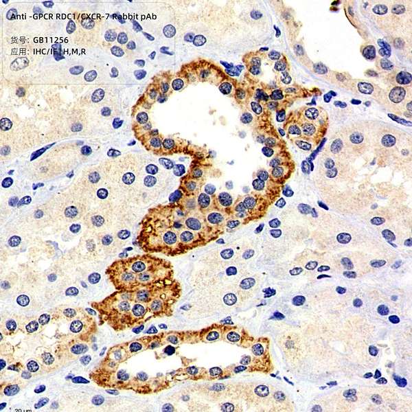 Антитела первичные, поликлональные, GPCR RDC1/CXCR-7, 100 мкл