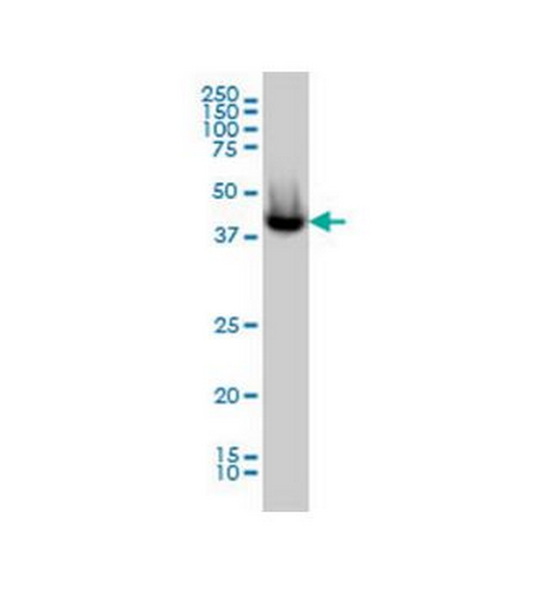 Антитела первичные, моноклональные ACATE2 (4E4), 100 мкг