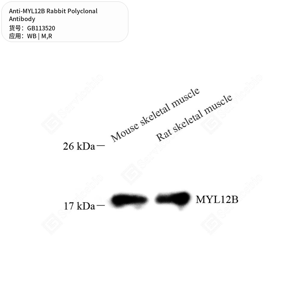 Антитела первичные, поликлональные кролика к MYL12B крысы, мыши, 100 мкл