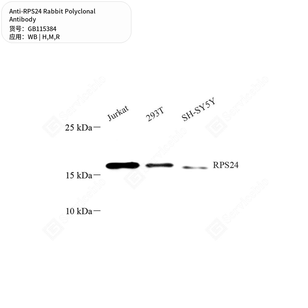 Антитела первичные, поликлональные кролика к RPS24 крысы, мыши, человека, 50 мкл