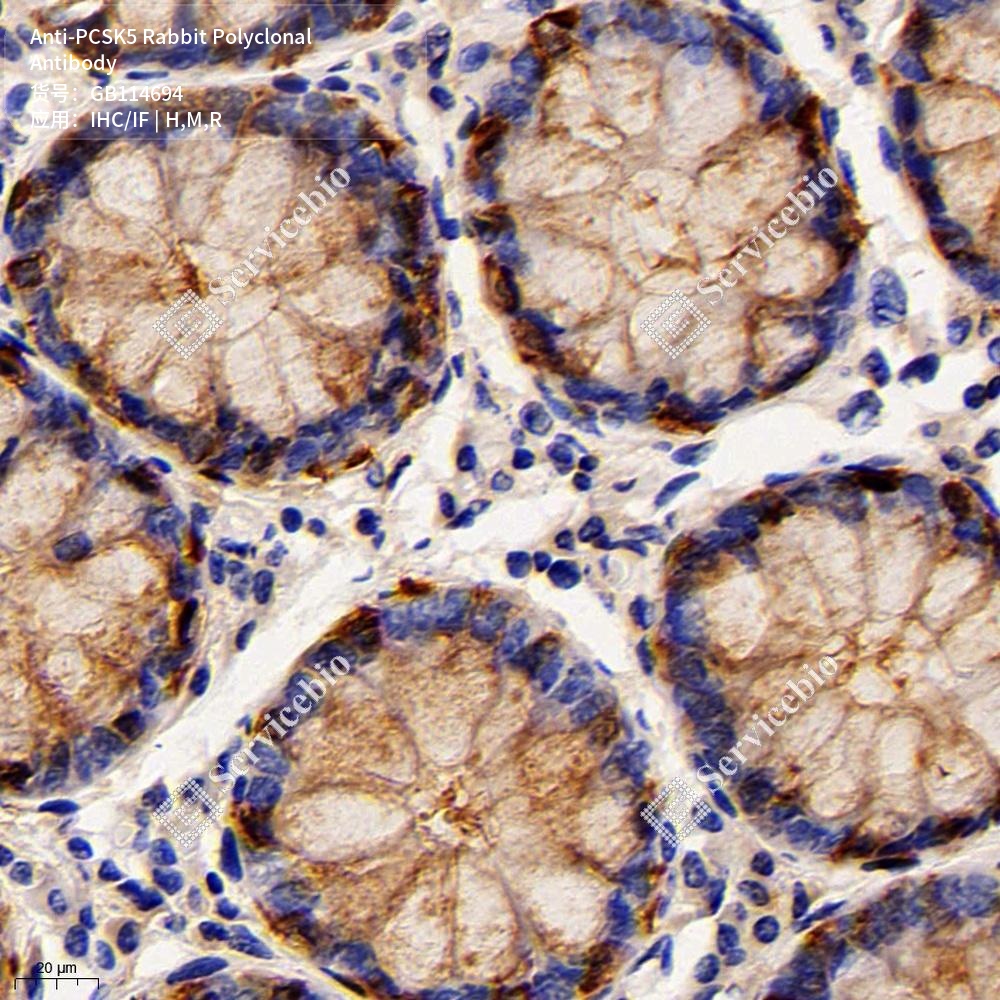 Антитела первичные, поликлональные кролика к PCSK5 крысы, мыши, человека, 100 мкл