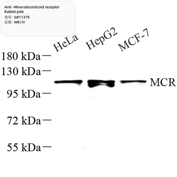 Антитела первичные, поликлональные, Mineralocorticoid receptor, 100 мкл