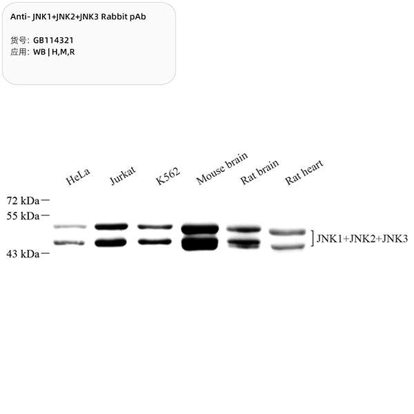 Антитела первичные, поликлональные, JNK1+JNK2+JNK3, 100 мкл
