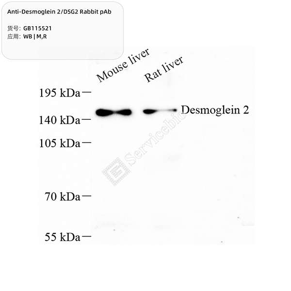 Антитела первичные, поликлональные, Desmoglein 2/DSG2, 100 мкл