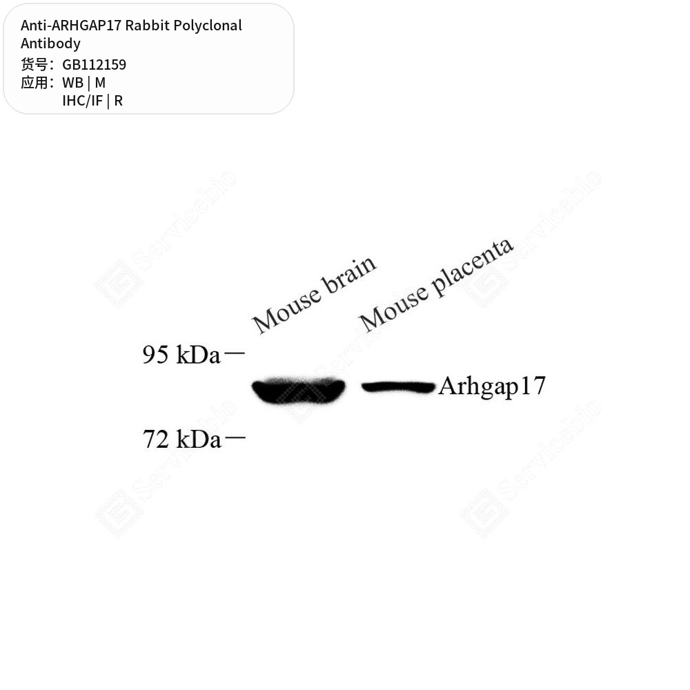 Антитела первичные, поликлональные кролика к ARHGAP17 крысы, мыши, 100 мкл