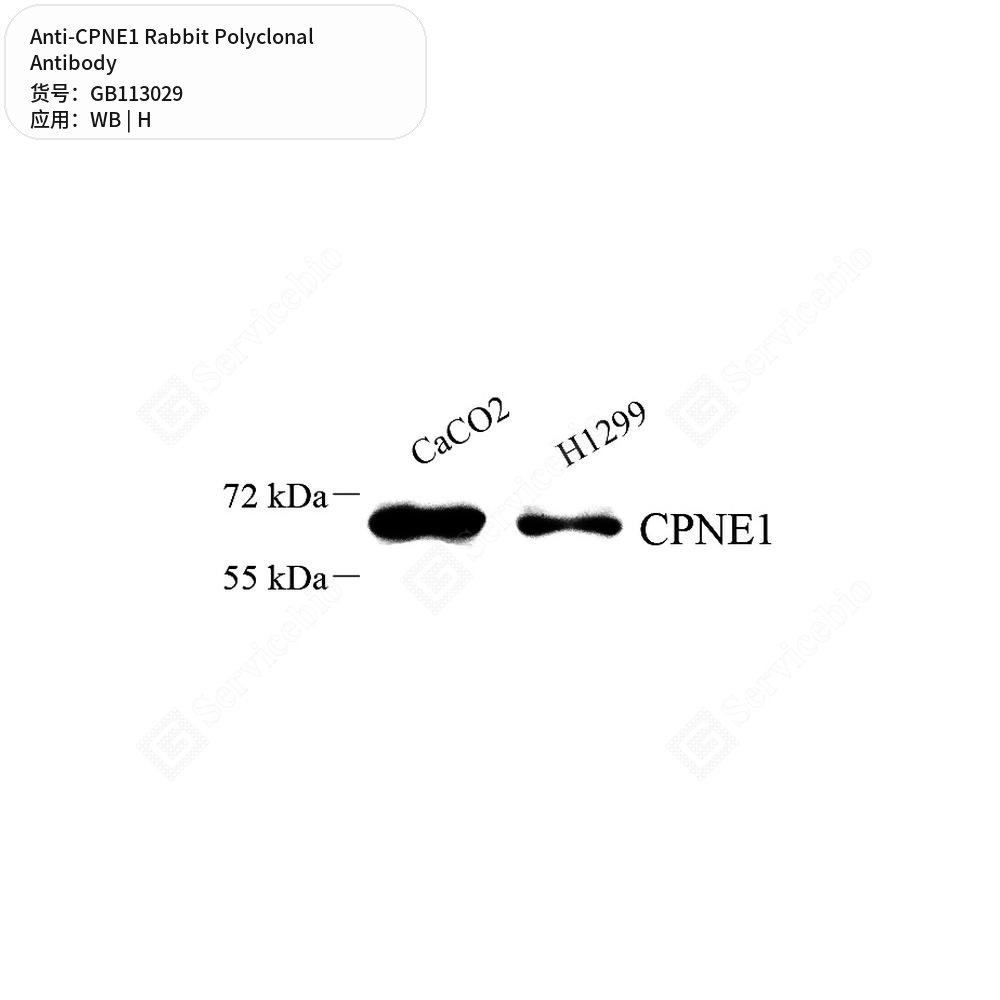 Антитела первичные, поликлональные кролика к CPNE1 человека, 100 мкл