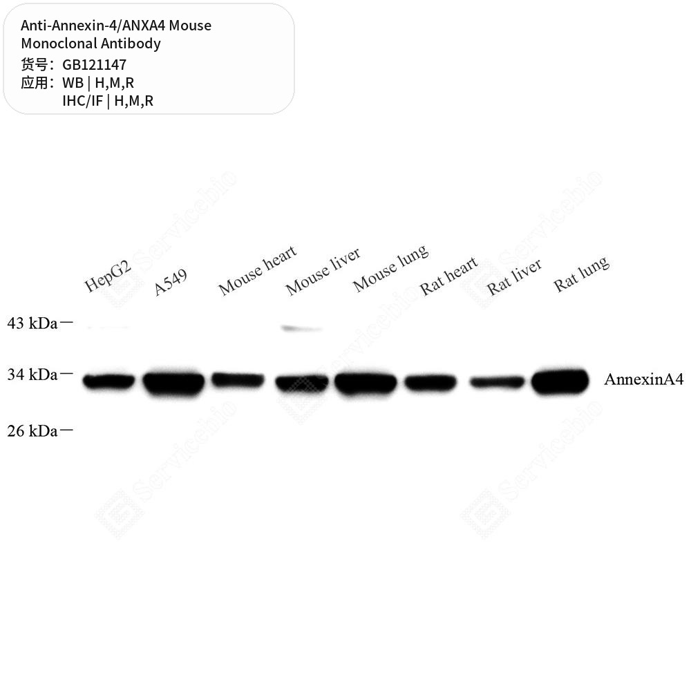 Антитела первичные, моноклональные мыши к Annexin-4/ANXA4 крысы, мыши, человека, 50 мкл