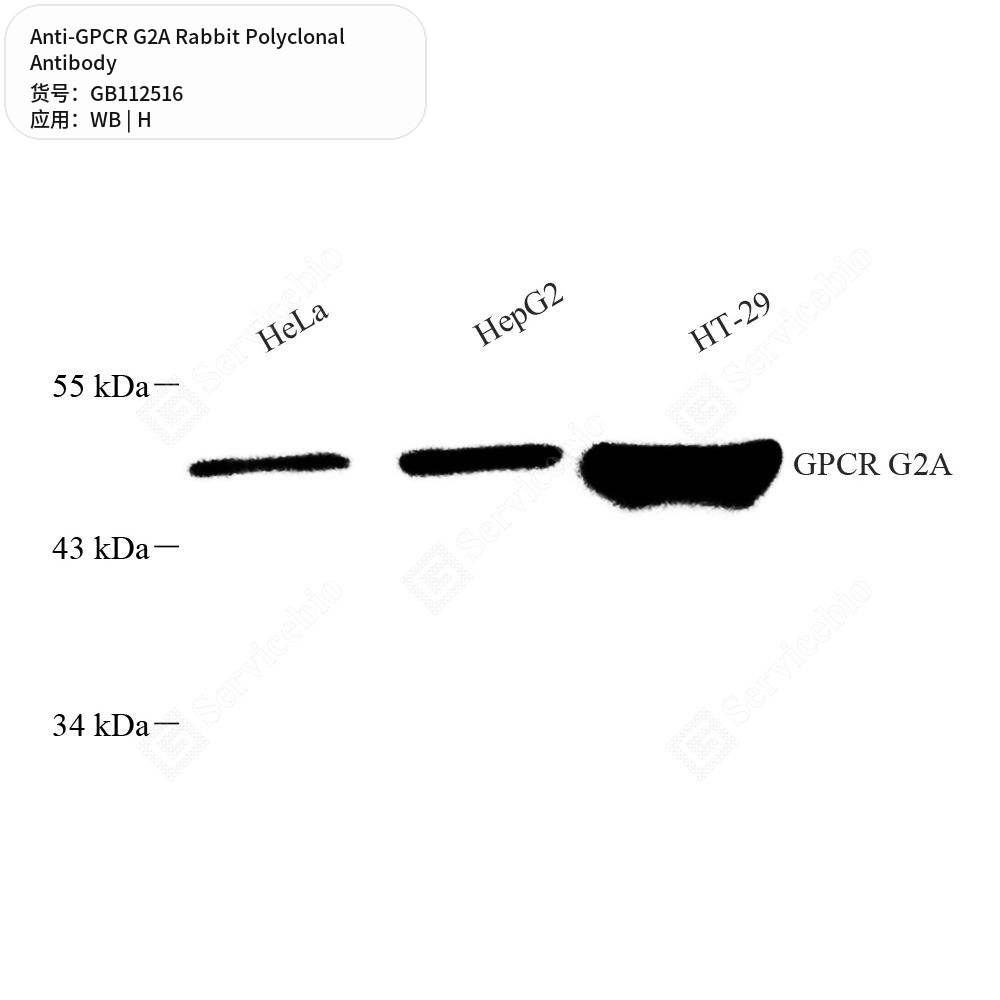 Антитела первичные, поликлональные кролика к GPCR G2A человека, 100 мкл