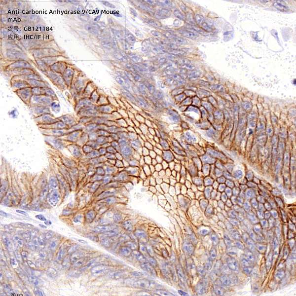 Антитела первичные, моноклональные, Carbonic Anhydrase 9/CA9, 100 мкл