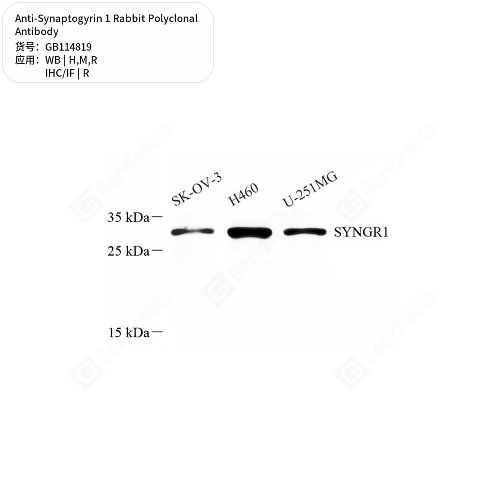 Антитела первичные, поликлональные кролика к Synaptogyrin 1 крысы, мыши, человека, 100 мкл